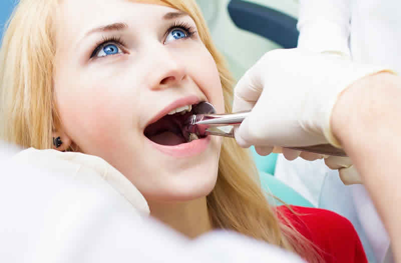 Wisdom teeth Extraction