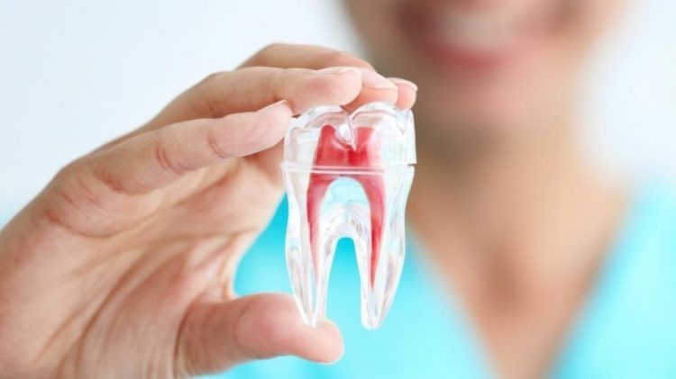 root canal therapy sydney
